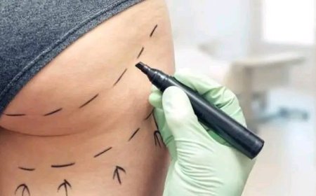 36-Year-Old Woman Dies During Buttocks Enlargement Procedure in Lagos Clinic