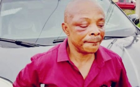 NLC Demands Justice Over Brutal Attack On Its President, Joe Ajaero One Year After