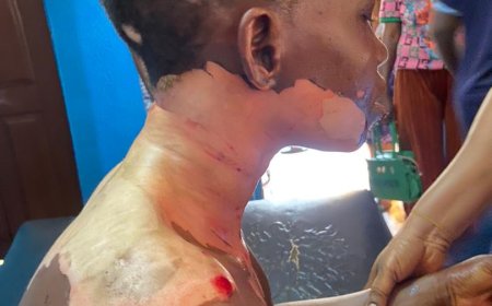 Ogun Police Arrest Man Who Reportedly Stabbed, Poured Hot Oil on Wife's Body