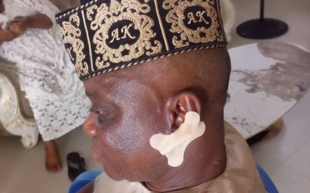 Sacrilege: How Community Leader Allegedly Attacked Ondo Monarch, Bites Off His Ear at Public Function