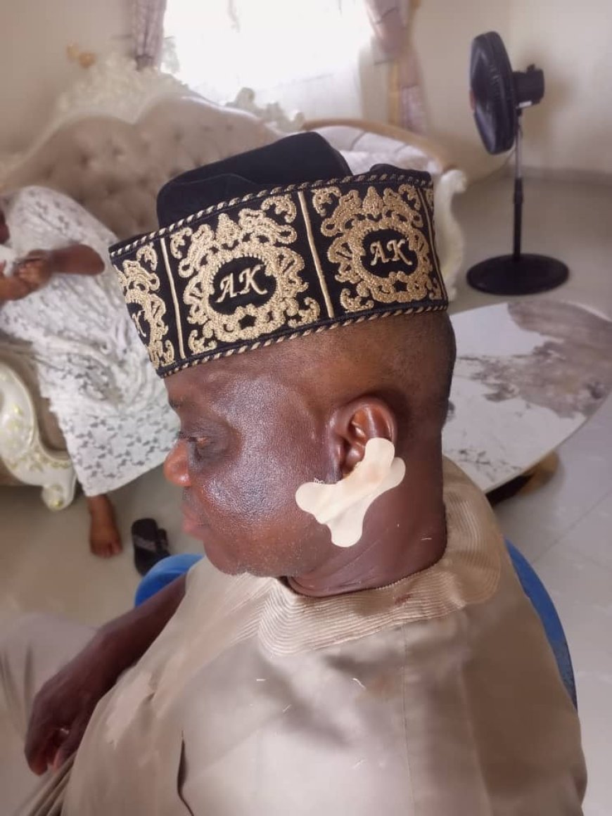 Sacrilege: How Community Leader Allegedly Attacked Ondo Monarch, Bites Off His Ear at Public Function