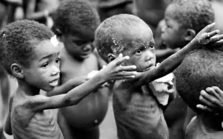 Malnutrition Crisis in Northern Nigeria Claims Over 650 Children Lives Within 7 Months of 2025 – MSF