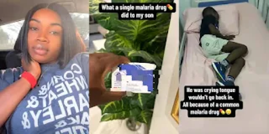 Mother Cries Out as Malaria Drug Causes Son’s Tongue to Hang Out, Sparks Online Outrage