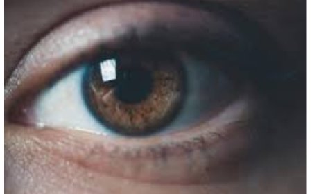 Stop Using Breast Milk For Eye Problems - Optometrist Warns