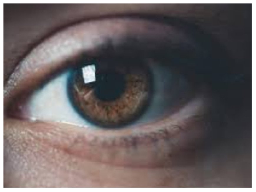 Stop Using Breast Milk For Eye Problems - Optometrist Warns